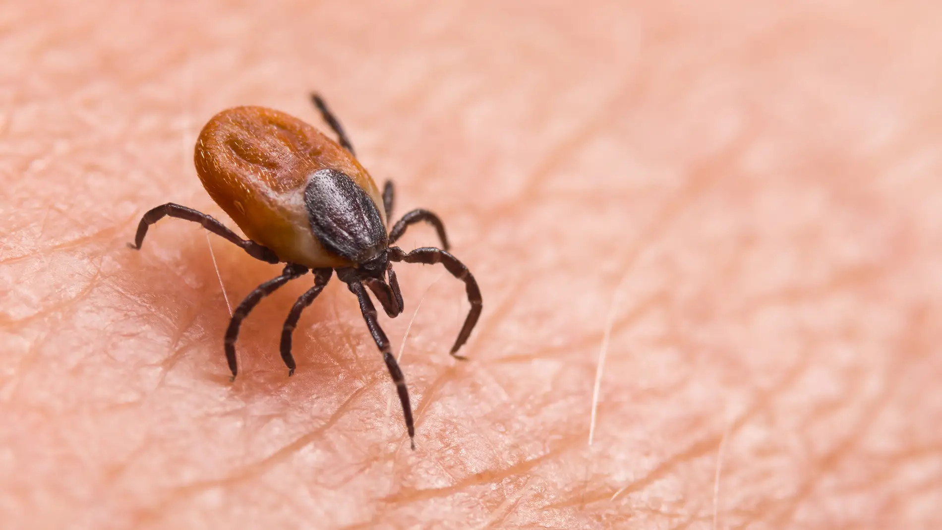 Alerta en la India: Aumentan los Casos Mortales de la ‘Fiebre del Mono’ Transmitida por Garrapatas